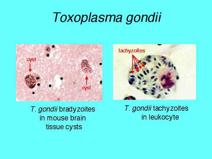 toxoplasma gondii