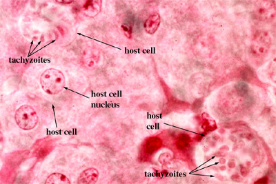 toxoplasma gondii4