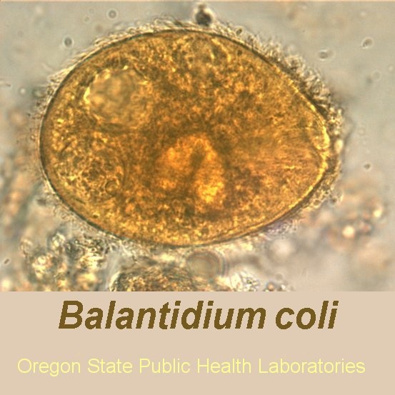 balantidium coli