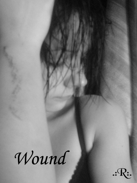 Wound